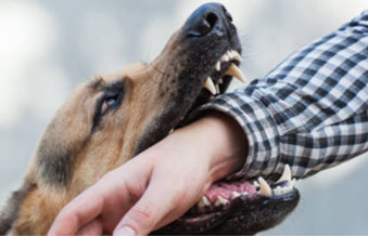 Dog Bites