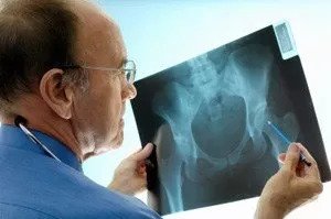 doctor checking x-ray