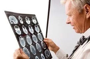 doctor looking at brain x-rays